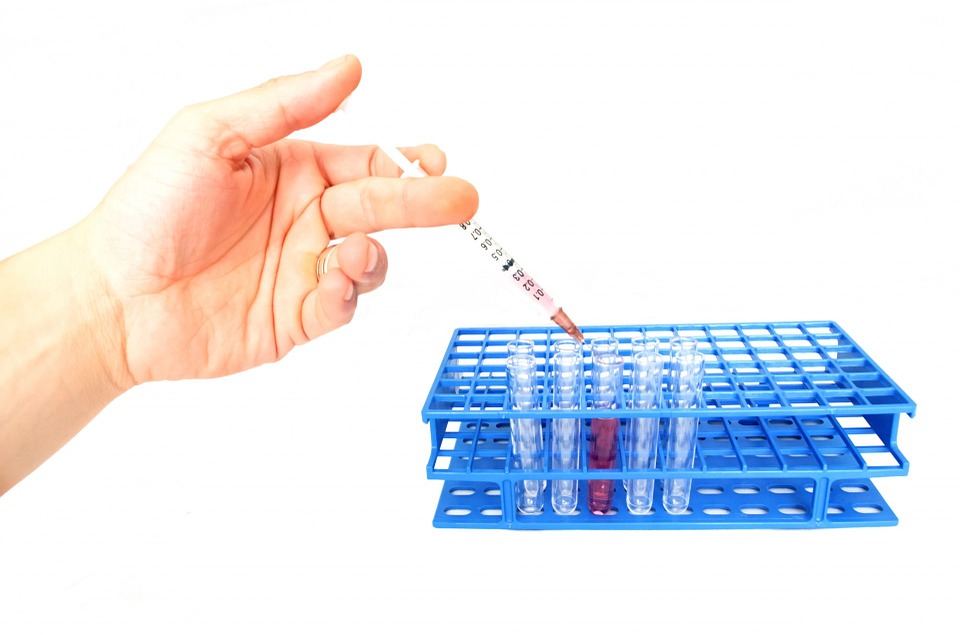 lab test