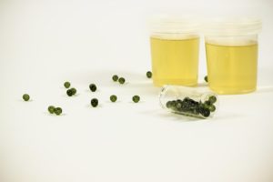 test urine